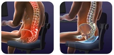 Tips to improve your posture with FORM Fitness Personal Training